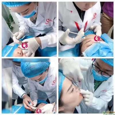 正規微整形培訓醫療美容培訓鄭州星美微整形培訓學校