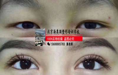 微整形培訓學校鄭州十大排行-培訓通