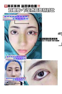 西安正規微整形培訓學校