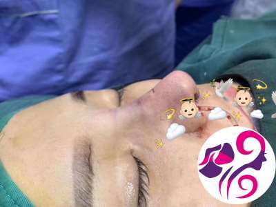 四川微整形醫學美容培訓學校哪家好