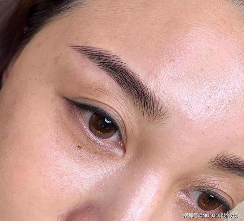 顧客右邊眼皮肌無(wú)力紋眉,我選擇操作機(jī)器線條眉來(lái)遮蓋