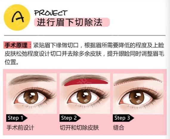 上海微整形培訓(xùn)機(jī)構(gòu) 匠育教育 半培訓(xùn) 微整培訓(xùn)