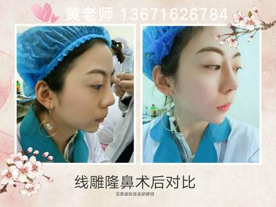 湖北哪里有微整形培訓學校